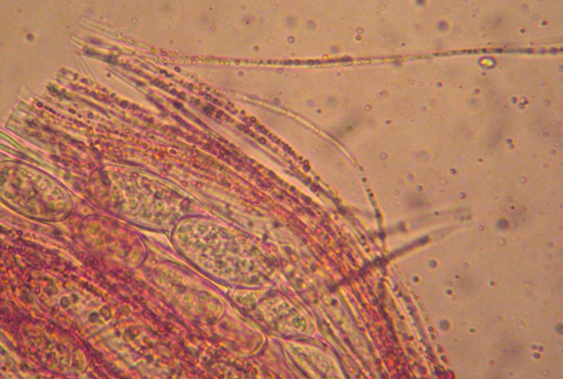 Sarcoscypha austriaca (?) con microscopia